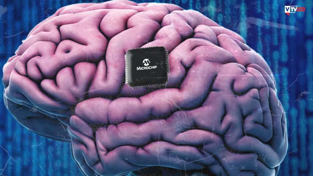 Stati Uniti, la Blackrock Neurotech ha impiantato nel cervello di oltre 30 persone un chip sperimentale chiamato NeuroPort Array